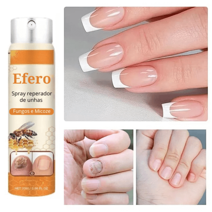 Efero Spray - Restaura Unhas e Elimina Fungos