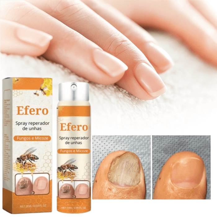 Efero Spray - Restaura Unhas e Elimina Fungos